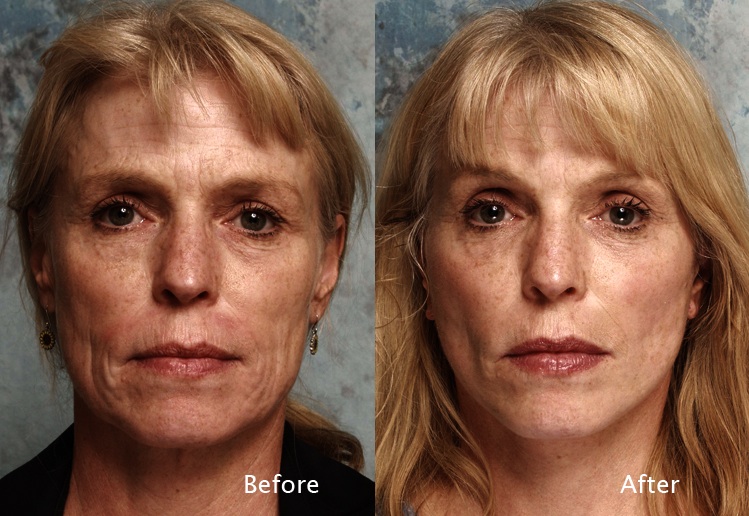 free how much does plastic surgery cost