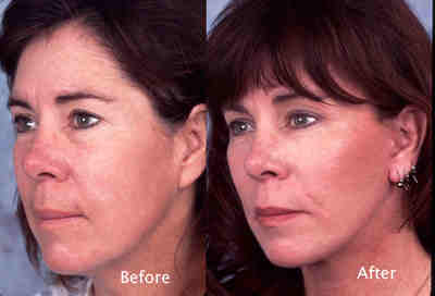 Face example Face-example
