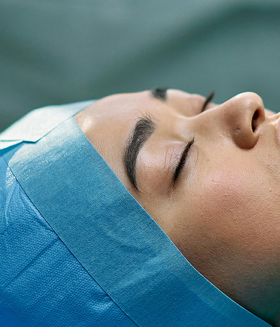 FOREHEAD LIFT