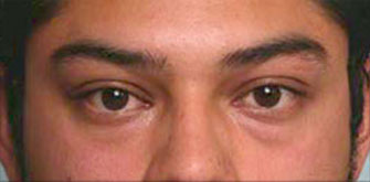 Before & Afters 