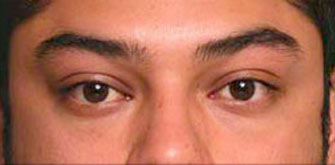 Before & Afters 