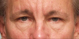 Before & Afters 