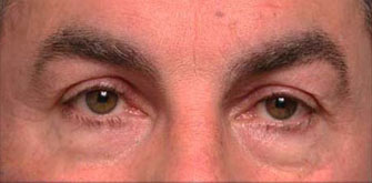 Before & Afters 
