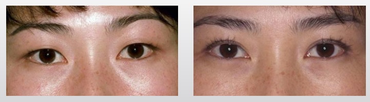 before-afters