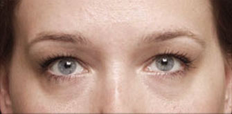 before-and-after 