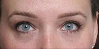 before-and-after 