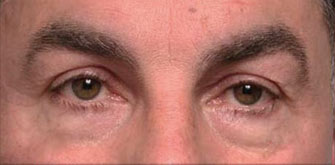 before-and-after 