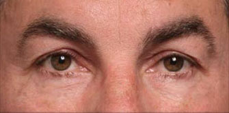 before-and-after 