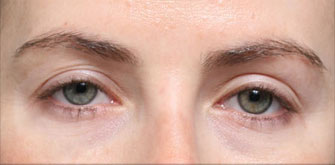 before-n-afters