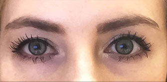 before-n-afters
