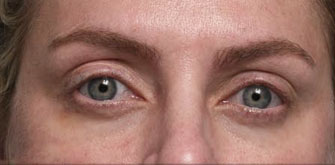 before-n-afters