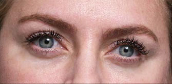 before-n-afters