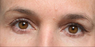 before-n-afters