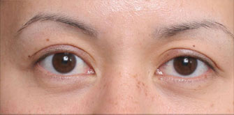 before-n-afters