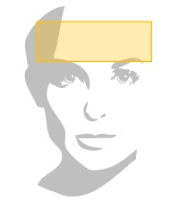 Forehead Lift Details Beverly Hills