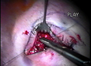 Case #3141