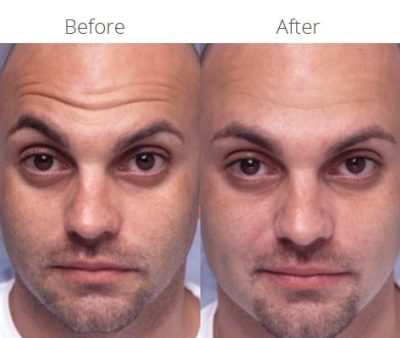 Non-Surgical Procedures