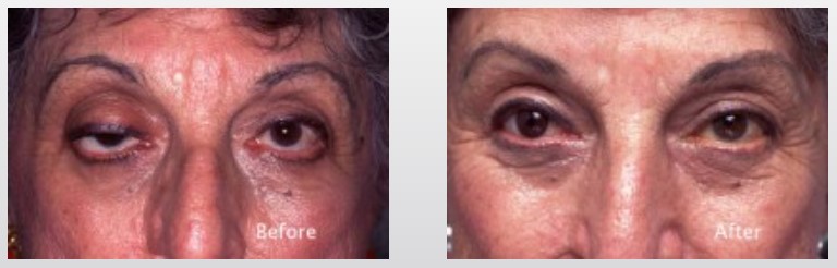 before-after