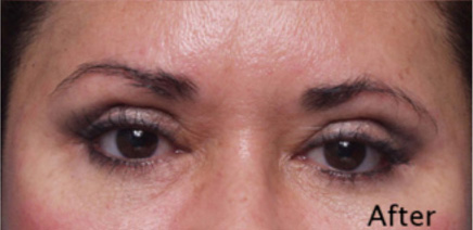 client-3157