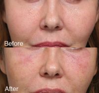 recognizing your face