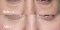 recognizing your face